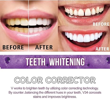 Toothpaste for Teeth Whitening (30ml) - Image 4