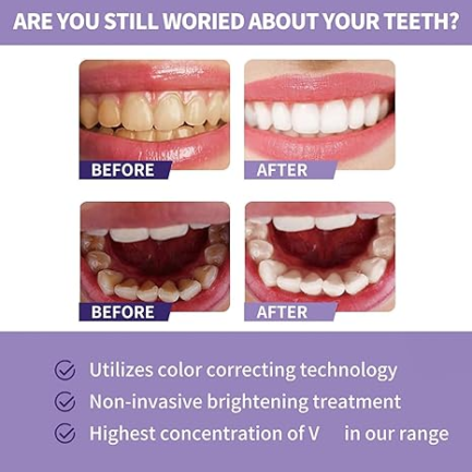 Toothpaste for Teeth Whitening (30ml) - Image 3